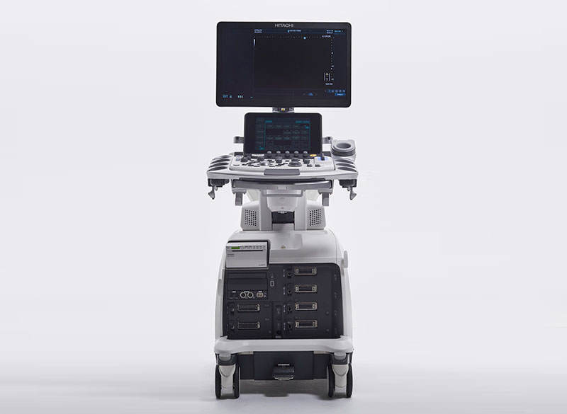 超音波画像診断装置